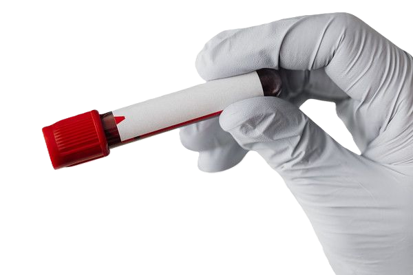 آزمایش خون برای تست HIV